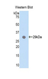 MYD88 Antibody - Western blot of recombinant MYD88.  This image was taken for the unconjugated form of this product. Other forms have not been tested.