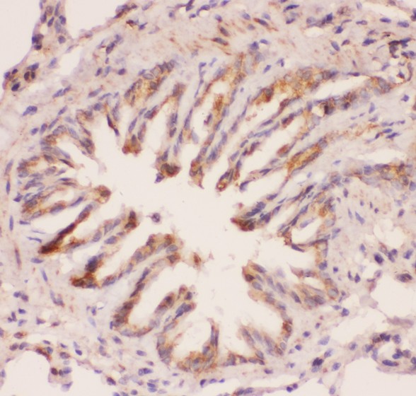 MYD88 Antibody - MyD88 antibody IHC-paraffin: Rat Lung Tissue.