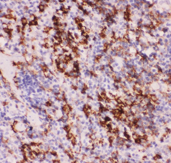 MYD88 Antibody - MyD88 antibody IHC-paraffin: Mouse Spleen Tissue.