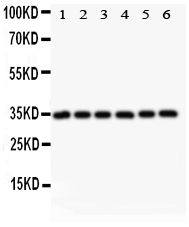 MYD88 Antibody - Western blot analysis of MYD88 using anti-MYD88 antibody. Electrophoresis was performed on a 5-20% SDS-PAGE gel at 70V (Stacking gel) / 90V (Resolving gel) for 2-3 hours. The sample well of each lane was loaded with 50ug of sample under reducing conditions. Lane 1: Rat Cardiac Muscle Tissue Lysate Lane 2: HELA Whole Cell Lysate Lane 3: MCF Whole Cell Lysate Lane 4: HEPG2 Whole Cell Lysate Lane 5: JURKAT Whole Cell Lysate Lane 6: RAJI Whole Cell Lysate After Electrophoresis, proteins were transferred to a Nitrocellulose membrane at 150mA for 50-90 minutes. Blocked the membrane with 5% Non-fat Milk/ TBS for 1.5 hour at RT. The membrane was incubated with rabbit anti-MYD88 antigen affinity purified polyclonal antibody at 0.5 µg/mL overnight at 4°C, then washed with TBS-0.1% Tween 3 times with 5 minutes each and probed with a goat anti-rabbit IgG-HRP secondary antibody at a dilution of 1:10000 for 1.5 hour at RT. The signal is developed using an Enhanced Chemiluminescent detection (ECL) kit with Tanon 5200 system. A specific band was detected for MYD88 at approximately 33KD. The expected band size for MYD88 is at 33KD.