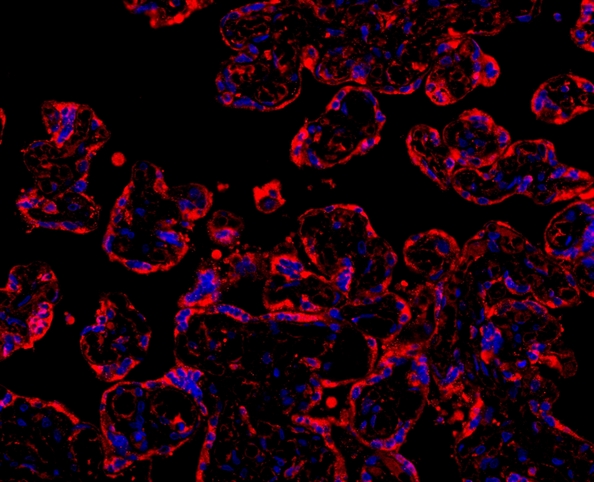 MYD88 Antibody - IF analysis of MYD88 using anti-MYD88 antibody MYD88 was detected in paraffin-embedded section of human placenta tissues. Heat mediated antigen retrieval was performed in citrate buffer (pH6, epitope retrieval solution ) for 20 mins. The tissue section was blocked with 10% goat serum. The tissue section was then incubated with 1µg/mL rabbit anti-MYD88 Antibody overnight at 4°C. Cy3 Conjugated Goat Anti-Rabbit IgG was used as secondary antibody at 1:100 dilution and incubated for 30 minutes at 37°C. The section was counterstained with DAPI. Visualize using a fluorescence microscope and filter sets appropriate for the label used.