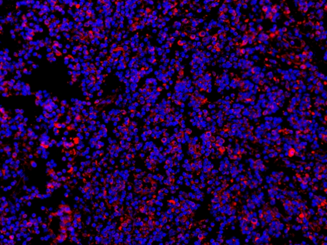 MYD88 Antibody - IF analysis of MYD88 using anti-MYD88 antibody MYD88 was detected in paraffin-embedded section of human tonsil tissues. Heat mediated antigen retrieval was performed in citrate buffer (pH6, epitope retrieval solution ) for 20 mins. The tissue section was blocked with 10% goat serum. The tissue section was then incubated with 1µg/mL rabbit anti-MYD88 Antibody overnight at 4°C. Cy3 Conjugated Goat Anti-Rabbit IgG was used as secondary antibody at 1:100 dilution and incubated for 30 minutes at 37°C. The section was counterstained with DAPI. Visualize using a fluorescence microscope and filter sets appropriate for the label used.