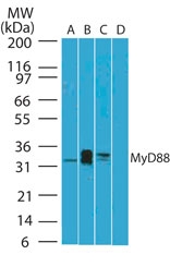 MYD88 Antibody - Western blot of MyD88 antibody in A) human ovary, B) human prostate and Jurkat cell lysate in the C) absence and D) presence of immunizing peptide using Monoclonal Antibody to MyD88(clone 4D6) antibody at 5 ug/ml. Goat anti-mouse Ig HRP secondary antibody, and PicoTect ECL substrate solution, were used for this test.
