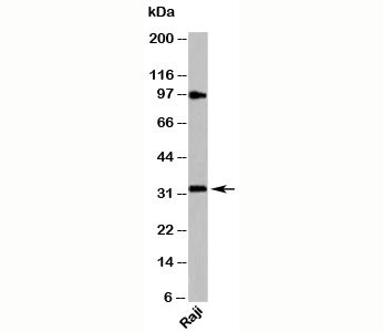 MYD88 Antibody - MyD88 antibody western blot of human samples