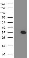 MYD88 Antibody - HEK293T cells were transfected with the pCMV6-ENTRY control (Left lane) or pCMV6-ENTRY MYD88 (Right lane) cDNA for 48 hrs and lysed. Equivalent amounts of cell lysates (5 ug per lane) were separated by SDS-PAGE and immunoblotted with anti-MYD88.