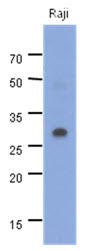 MYD88 Antibody - Western Blot: The cell lysates of Raji (40 ug) were resolved by SDS-PAGE, transferred to PVDF membrane and probed with anti-human MYD88 antibody (1:1000). Proteins were visualized using a goat anti-mouse secondary antibody conjugated to HRP and an ECL detection system.