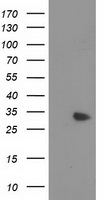 MYD88 Antibody - HEK293T cells were transfected with the pCMV6-ENTRY control (Left lane) or pCMV6-ENTRY MYD88 (Right lane) cDNA for 48 hrs and lysed. Equivalent amounts of cell lysates (5 ug per lane) were separated by SDS-PAGE and immunoblotted with anti-MYD88.