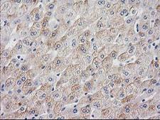 MYD88 Antibody - IHC of paraffin-embedded Human liver tissue using anti-MYD88 mouse monoclonal antibody.