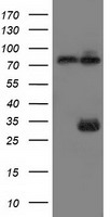 MYD88 Antibody - HEK293T cells were transfected with the pCMV6-ENTRY control (Left lane) or pCMV6-ENTRY MYD88 (Right lane) cDNA for 48 hrs and lysed. Equivalent amounts of cell lysates (5 ug per lane) were separated by SDS-PAGE and immunoblotted with anti-MYD88.