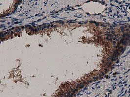 MYD88 Antibody - IHC of paraffin-embedded Human prostate tissue using anti-MYD88 mouse monoclonal antibody.