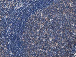 MYD88 Antibody - IHC of paraffin-embedded Human lymph node tissue using anti-MYD88 mouse monoclonal antibody.