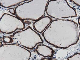 MYD88 Antibody - IHC of paraffin-embedded Human thyroid tissue using anti-MYD88 mouse monoclonal antibody.