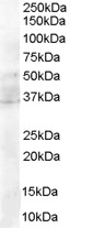 MYD88 Antibody - Staining (0.01 ug/ml) of MOLT4 lysate (RIPA buffer, 35 ug total protein per lane). Primary incubated for 1 hour. Detected using chemiluminescence.
