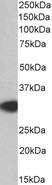 MYD88 Antibody - MYD88 antibody staining (0.2ug/ml) of Human Thymus lysate (RIPA buffer, 35ug total protein per lane). Primary incubated for 1 hour. Detected by chemiluminescence.