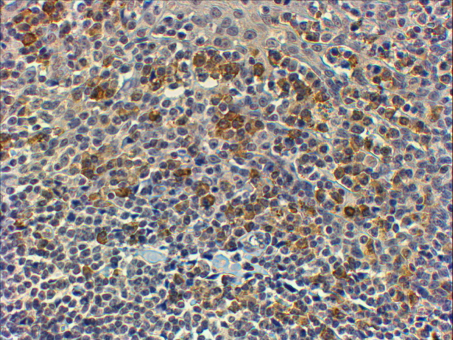 MYD88 Antibody - MYD88 Antibody (4µg/ml) staining of paraffin embedded Human Tonsil. Steamed antigen retrieval with Tris/EDTA buffer pH 9, HRP-staining. These results could not been obtained after antigen retireval at pH6 with this batch of antibody.