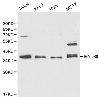 MYD88 Antibody - Western blot of MYD88 pAb in extracts from Jurkat, K562, Hela and MCF7 cells.