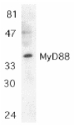 MYD88 Antibody - Western blot of MyD88 in Jurkat whole cell lysate with MyD88 antibody at 1:500 dilution.