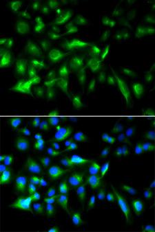 MYD88 Antibody - Immunofluorescence analysis of HeLa cells.