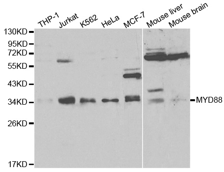 MYD88 Antibody - Western blot analysis of extracts of various cell lines, using MyD88 antibody at 1:1000 dilution. The secondary antibody used was an HRP Goat Anti-Rabbit IgG (H+L) at 1:10000 dilution. Lysates were loaded 25ug per lane and 3% nonfat dry milk in TBST was used for blocking.