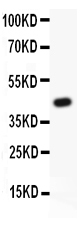 MYD88 Antibody - Western blot testing of MyD88 antibody (0.5ug/ml) and recombinant human protein (0.5ng)