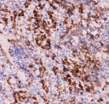 MYD88 Antibody - IHC-P: MyD88 antibody testing of mouse spleen tissue