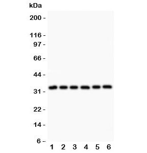 MYD88 Antibody - Western blot testing of MyD88 antibody and Lane 1: rat heart; 2: human HeLa; 3: (h) MCF7; 4: (h) HEPG2; 5: (h) Jurkat; 6: (h) Raji. Predicted molecular weight: 33 kDa