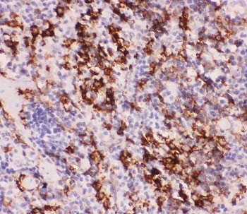 MYD88 Antibody - IHC-P staining of mouse spleen tissue