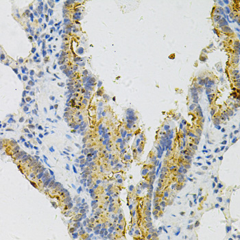 MYD88 Antibody - Immunohistochemistry of paraffin-embedded rat lung using MYD88 Antibody at dilution of 1:100 (40x lens).