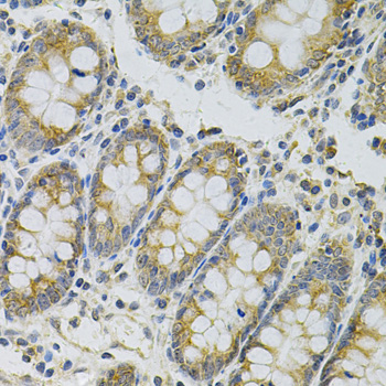 MYD88 Antibody - Immunohistochemistry of paraffin-embedded human colon using MYD88 Antibody at dilution of 1:100 (40x lens).