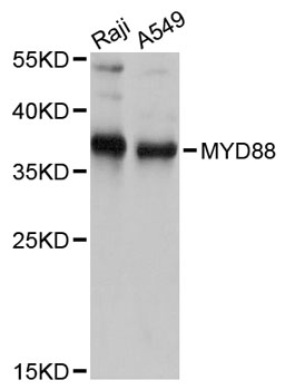 MYD88 Antibody - Western blot analysis of extracts of various cell lines, using MYD88 antibody at 1:1000 dilution. The secondary antibody used was an HRP Goat Anti-Rabbit IgG (H+L) at 1:10000 dilution. Lysates were loaded 25ug per lane and 3% nonfat dry milk in TBST was used for blocking. An ECL Kit was used for detection and the exposure time was 3s.