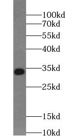 MYD88 Antibody - Jurkat cells were subjected to SDS PAGE followed by western blot with MYD88 antibody at dilution of 1:1000