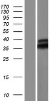 MYD88 Protein - Western validation with an anti-DDK antibody * L: Control HEK293 lysate R: Over-expression lysate