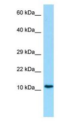 MYDGF / SF20 Antibody - C19orf10 / SF20 antibody Western Blot of Human Placenta.  This image was taken for the unconjugated form of this product. Other forms have not been tested.