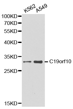MYDGF / SF20 Antibody - Western blot analysis of K562 cell and A549 cell lysate.