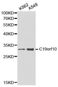 MYDGF / SF20 Antibody - Western blot analysis of K562 cell and A549 cell lysate.