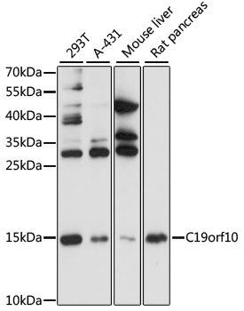 MYDGF / SF20 Antibody - Western blot analysis of extracts of various cell lines, using C19orf10 antibody at 1:1000 dilution. The secondary antibody used was an HRP Goat Anti-Rabbit IgG (H+L) at 1:10000 dilution. Lysates were loaded 25ug per lane and 3% nonfat dry milk in TBST was used for blocking. An ECL Kit was used for detection and the exposure time was 90s.