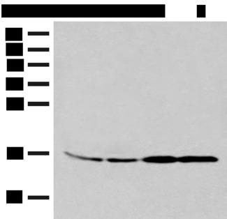 MYDGF / SF20 Antibody - Western blot analysis of 293T and K562 cell Human between peritoneal stromal sarcoma tissue HEPG2 cell lysates  using MYDGF Polyclonal Antibody at dilution of 1:250
