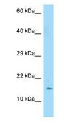 MYDGF / SF20 Antibody - C19orf10 / SF20 antibody Western Blot of MCF7.  This image was taken for the unconjugated form of this product. Other forms have not been tested.