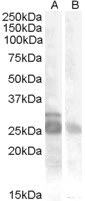 MYF5 / MYF 5 Antibody - Antibody (0.5 ug/ml) staining of Muscle lysate (35 ug protein in RIPA buffer) with (B) and without (A) blocking with the immunizing peptide. Primary incubation was 1 hour. Detected by chemiluminescence.