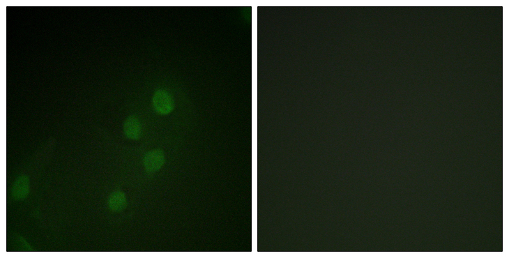 MYF5 / MYF 5 Antibody - Immunofluorescence analysis of HeLa cells, using MYF5 Antibody. The picture on the right is blocked with the synthesized peptide.
