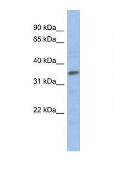 MYF5 / MYF 5 Antibody - MYF5 antibody ARP32134_P050-NP_005584-MYF5 (myogenic factor 5) Antibody Western blot of Jurkat Cell lysate. Antibody concentration 1 ug/ml.  This image was taken for the unconjugated form of this product. Other forms have not been tested.