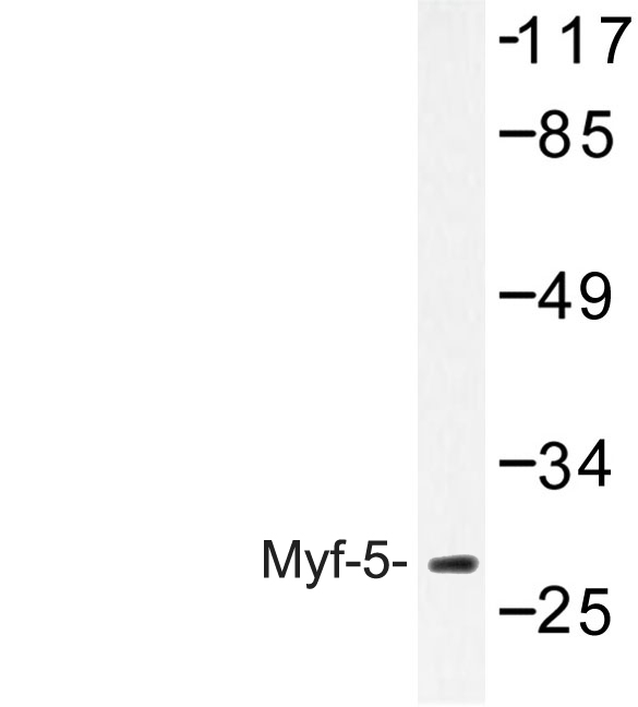 MYF5 / MYF 5 Antibody - Western blot of Myf-5 (A88) pAb in extracts from HepG2 cells.