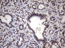 MYF5 / MYF 5 Antibody - IHC of paraffin-embedded Human breast tissue using anti-MYF5 mouse monoclonal antibody. (Heat-induced epitope retrieval by 1 mM EDTA in 10mM Tris, pH8.5, 120°C for 3min).