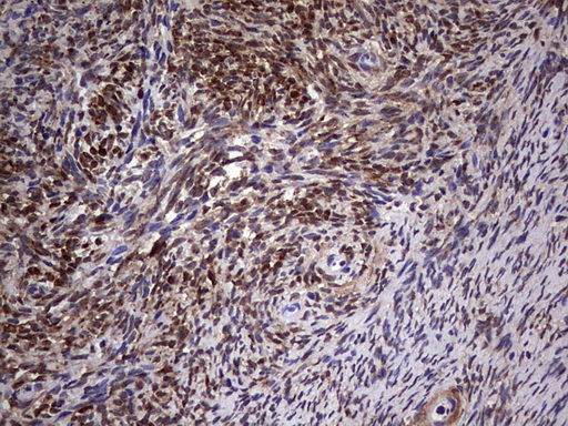 MYF5 / MYF 5 Antibody - IHC of paraffin-embedded Human Ovary tissue using anti-MYF5 mouse monoclonal antibody. (Heat-induced epitope retrieval by 1 mM EDTA in 10mM Tris, pH8.5, 120°C for 3min).