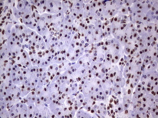 MYF5 / MYF 5 Antibody - IHC of paraffin-embedded Human pancreas tissue using anti-MYF5 mouse monoclonal antibody. (Heat-induced epitope retrieval by 1 mM EDTA in 10mM Tris, pH8.5, 120°C for 3min).