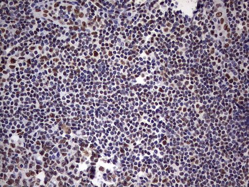 MYF5 / MYF 5 Antibody - IHC of paraffin-embedded Human tonsil using anti-MYF5 mouse monoclonal antibody. (Heat-induced epitope retrieval by 1 mM EDTA in 10mM Tris, pH8.5, 120°C for 3min).