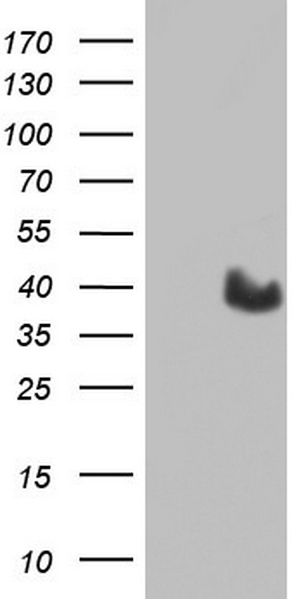 MYF5 / MYF 5 Antibody - HEK293T cells were transfected with the pCMV6-ENTRY control (Left lane) or pCMV6-ENTRY MYF5 (Right lane) cDNA for 48 hrs and lysed. Equivalent amounts of cell lysates (5 ug per lane) were separated by SDS-PAGE and immunoblotted with anti-MYF5.