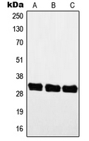 MYF5 / MYF 5 Antibody - Western blot analysis of MYF5 expression in A549 (A); mouse muscle (B); rat muscle (C) whole cell lysates.