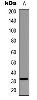 MYF5 / MYF 5 Antibody - Western blot analysis of MYF5 expression in Jurkat (A) whole cell lysates.