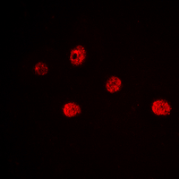 MYF5 / MYF 5 Antibody - Immunofluorescent analysis of MYF5 staining in Jurkat cells. Formalin-fixed cells were permeabilized with 0.1% Triton X-100 in TBS for 5-10 minutes and blocked with 3% BSA-PBS for 30 minutes at room temperature. Cells were probed with the primary antibody in 3% BSA-PBS and incubated overnight at 4 deg C in a humidified chamber. Cells were washed with PBST and incubated with a DyLight 594-conjugated secondary antibody (red) in PBS at room temperature in the dark. DAPI was used to stain the cell nuclei (blue).